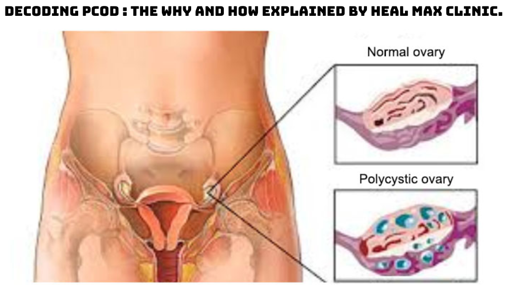 Pcod Heal Max Clinic and research center.