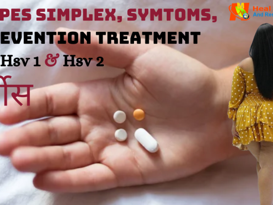 Herpes Demystified: Oral, Genital Types, and Effective Treatments