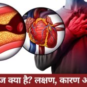हार्ट ब्लॉकेज इलाज